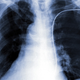 Illustration for article titled Power your pacemaker with your heartbeat